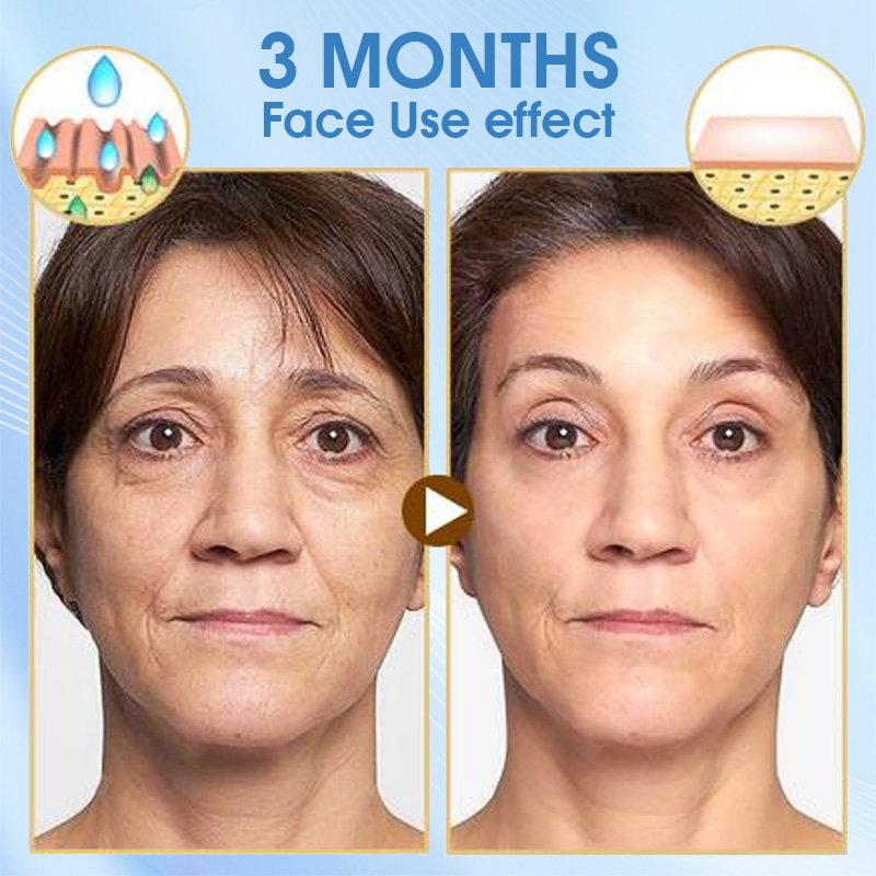 Creme Diurno de Coenzima Q10 5 - Coenzyme Q10 Cream avaliação e preço